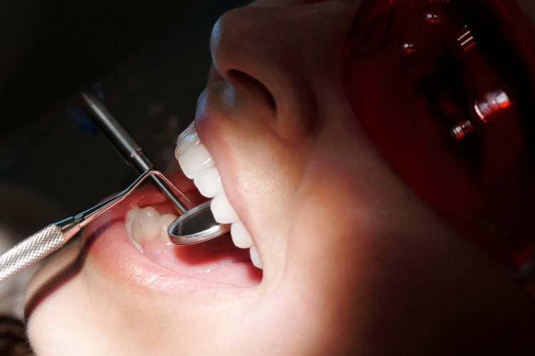 reparation dents templeuveAccueilCabinet Rue Neuve | Chirurgiens-dentistes Templeuve-en-Pévèle